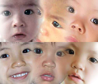 health blog babies
