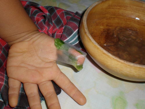 aloe-vera-burn-treatment-toddler.jpg
