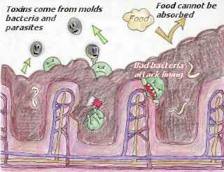 Dirty Colon from www.chineseenergytherapy.co.nz
